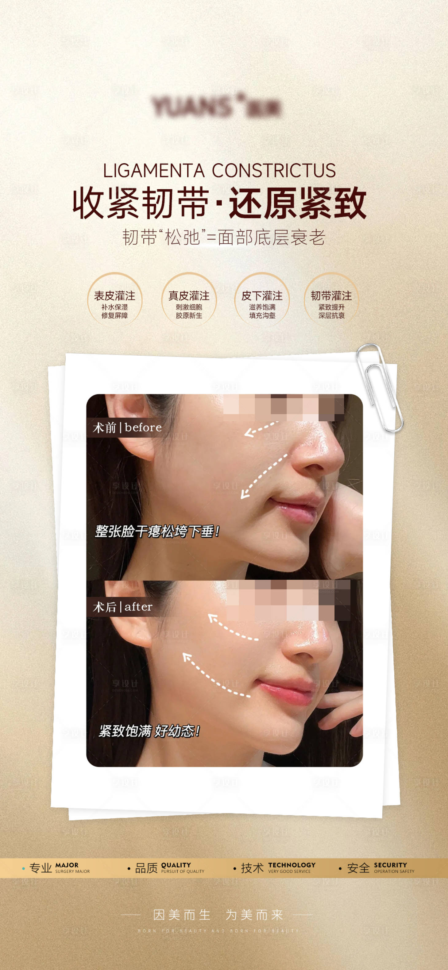 源文件下載【享設計】搜索編號：68790029832428810【醫美韌帶提升案例海報】