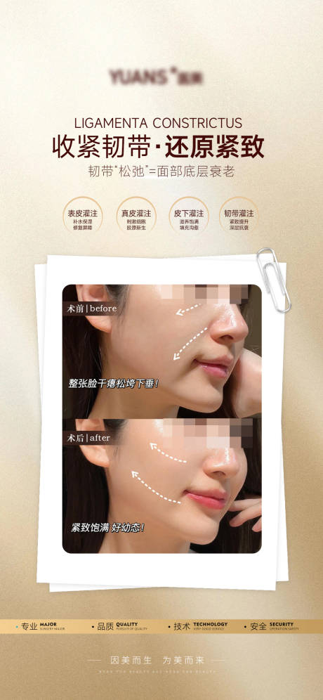 医美韧带提升案例海报