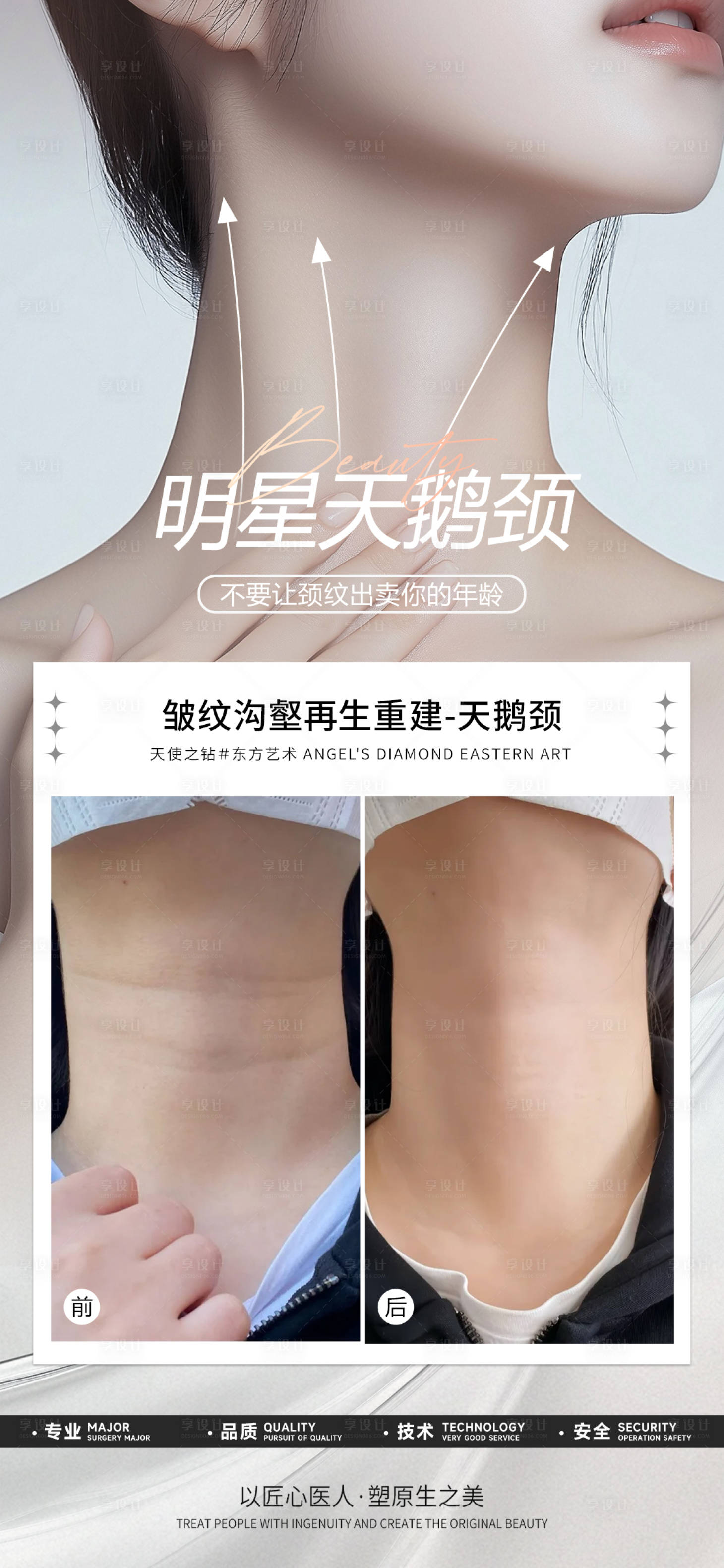 源文件下載【享設計】搜索編號：15320029518921295【醫美天鵝頸案例海報】
