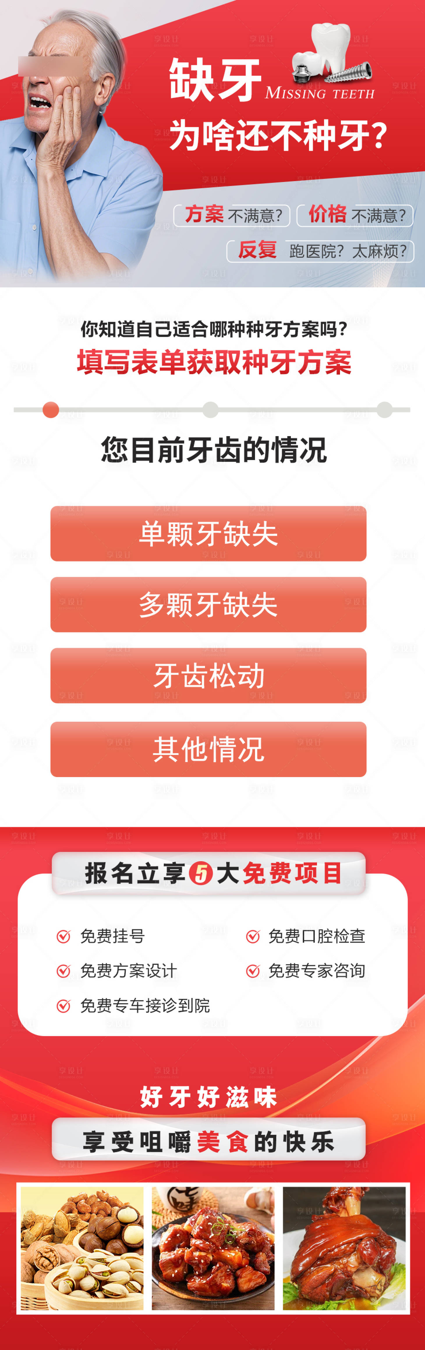 源文件下載【享設(shè)計(jì)】搜索編號(hào)：15050029678256728【缺牙方案種牙長(zhǎng)圖】