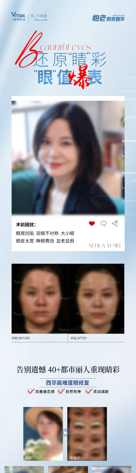 源文件下载【医美双眼皮修复案例】编号：97270029280946403