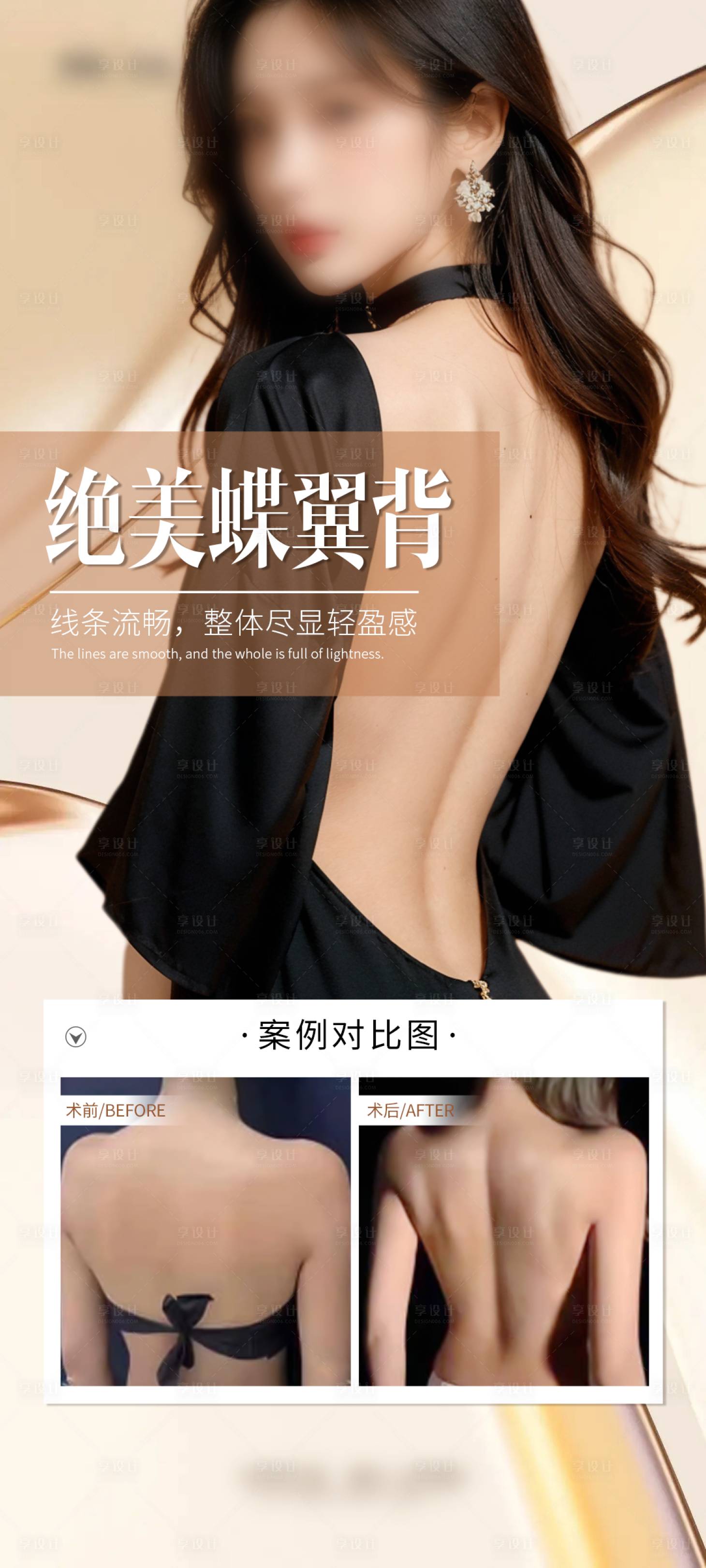 源文件下载【医美美背案例海报】编号：77320029380992041