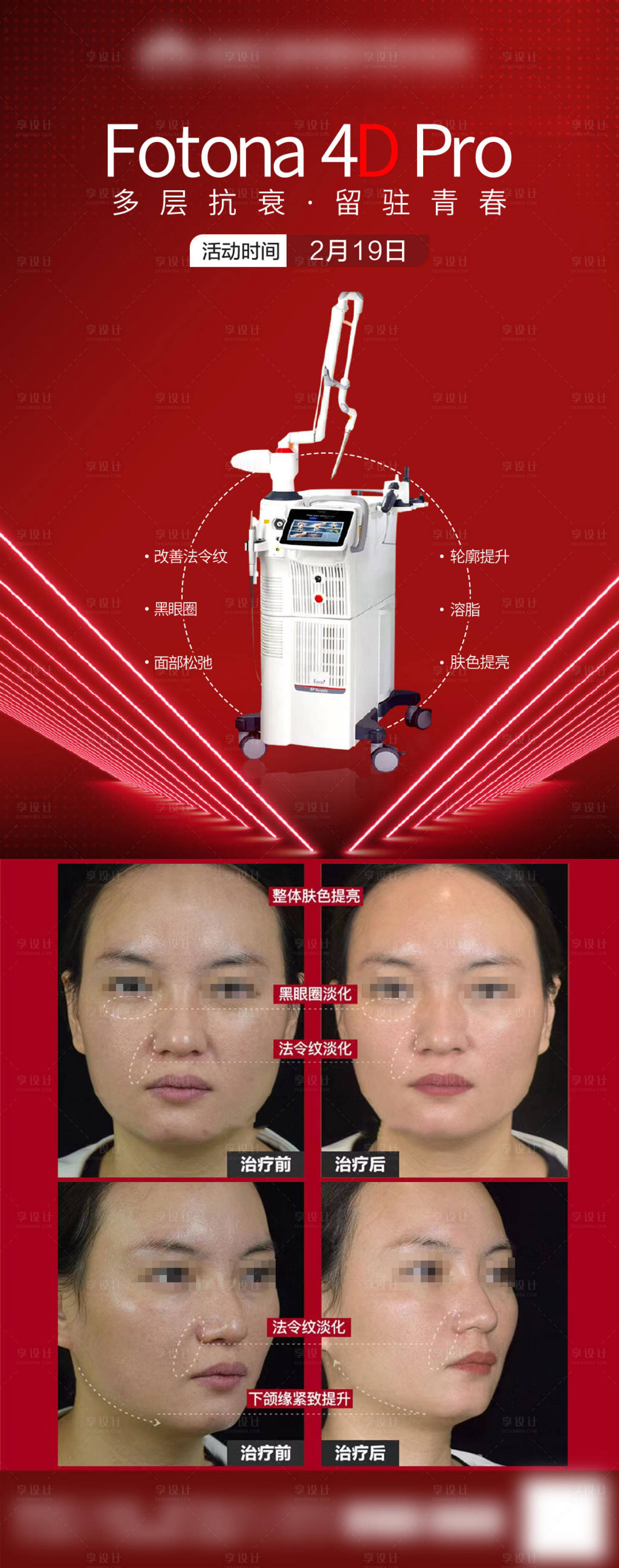 源文件下载【享设计】搜索编号：29080029424754802【欧洲之星抗衰案例海报】