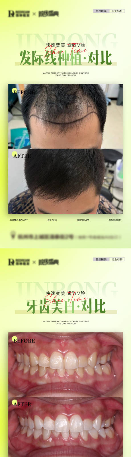 源文件下载【医美口腔植发案例海报】编号：42690029381845620