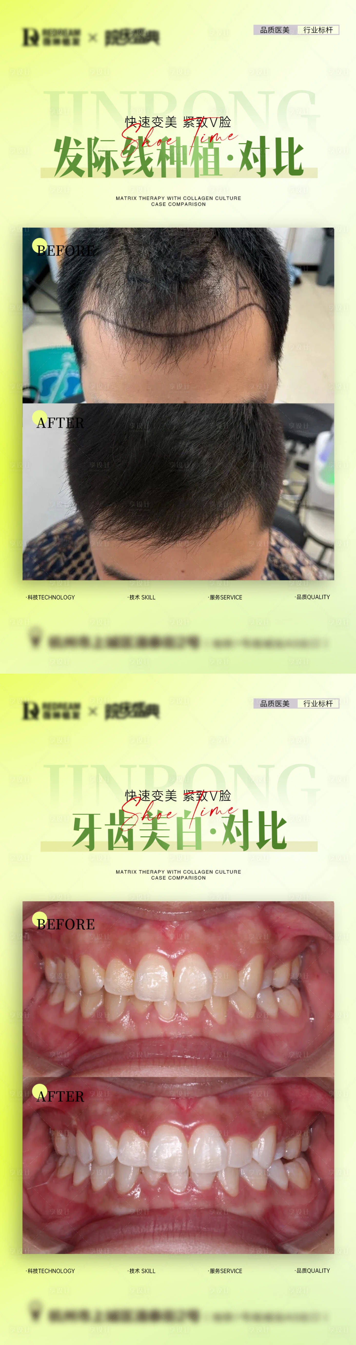 源文件下載【享設(shè)計(jì)】搜索編號(hào)：42690029381845620【醫(yī)美口腔植發(fā)案例海報(bào)】
