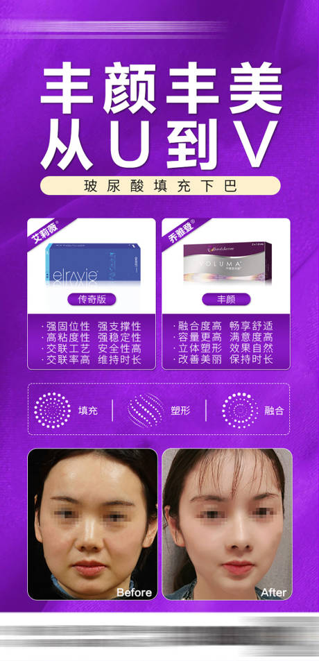 源文件下载【医美玻尿酸案例推广海报】编号：66960029457989821