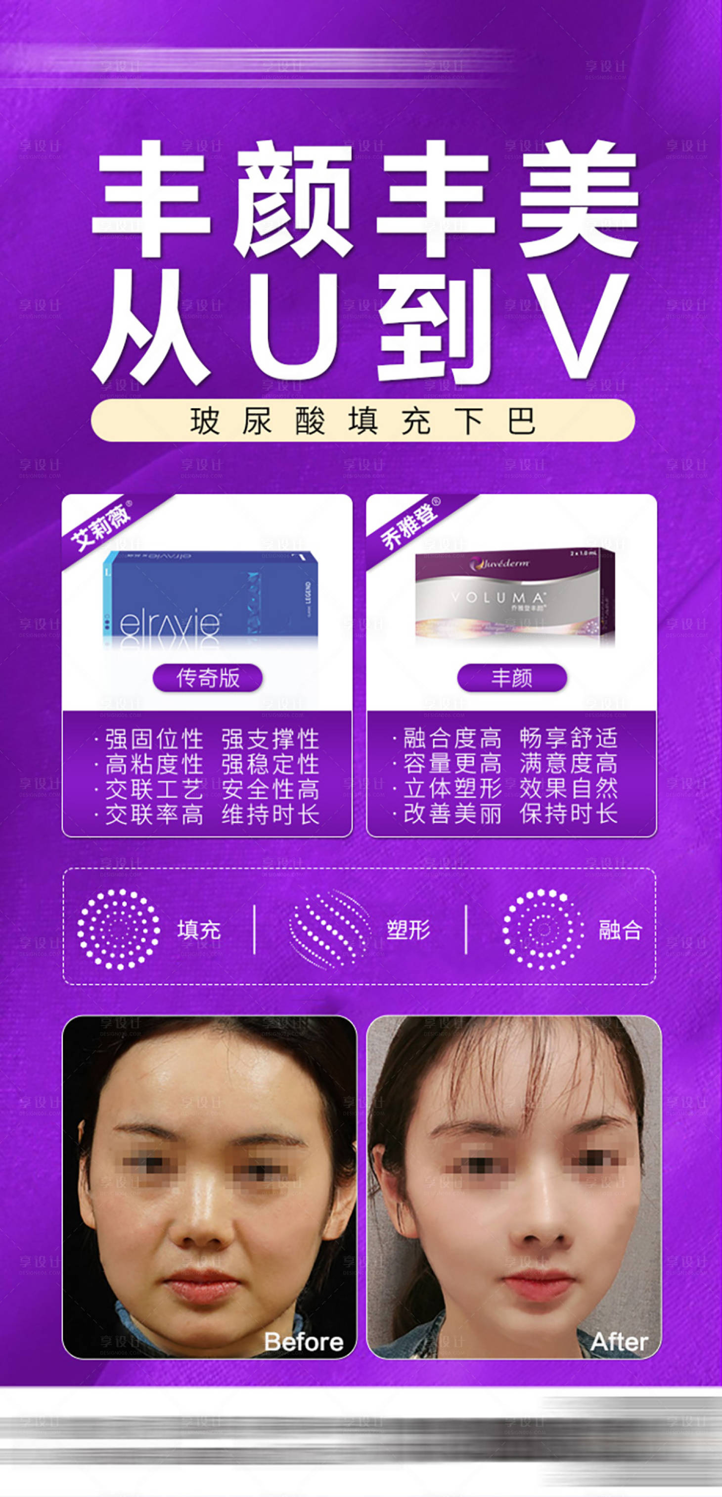 源文件下載【享設計】搜索編號：66960029457989821【醫美玻尿酸案例推廣海報】