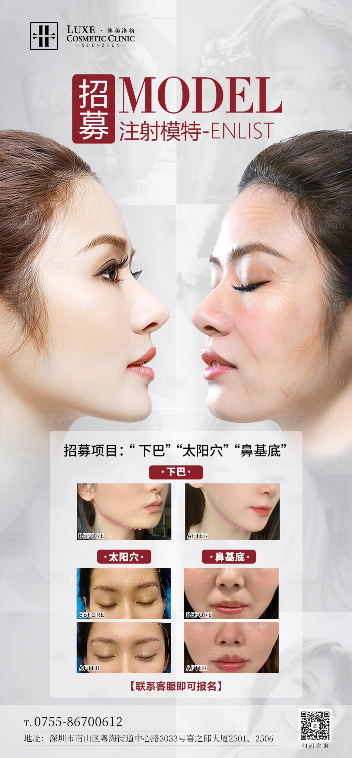 源文件下載【享設(shè)計】搜索編號：64520029164657788【醫(yī)美注射打版模特招募】