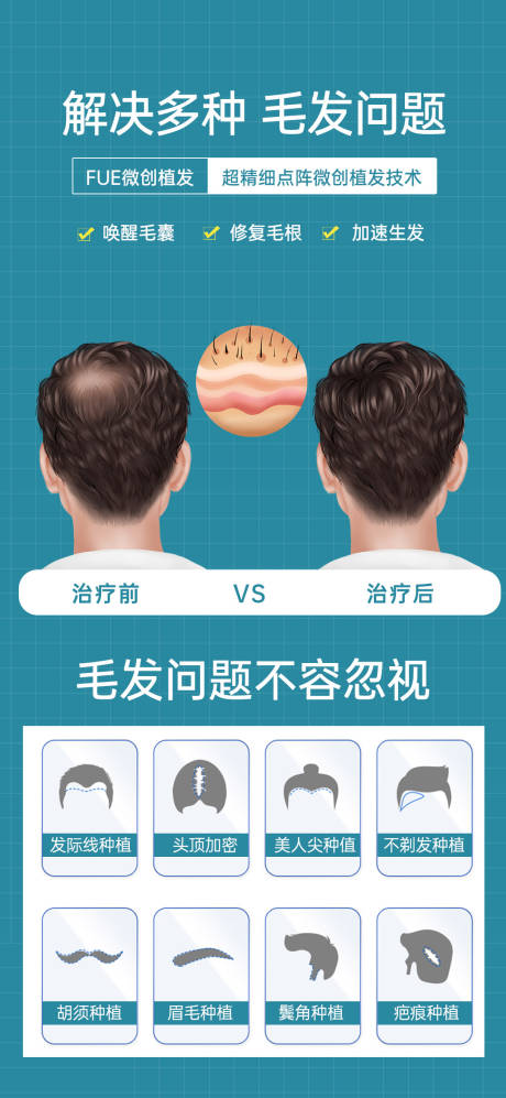 源文件下载【FUE植发海报】编号：76200029795346630