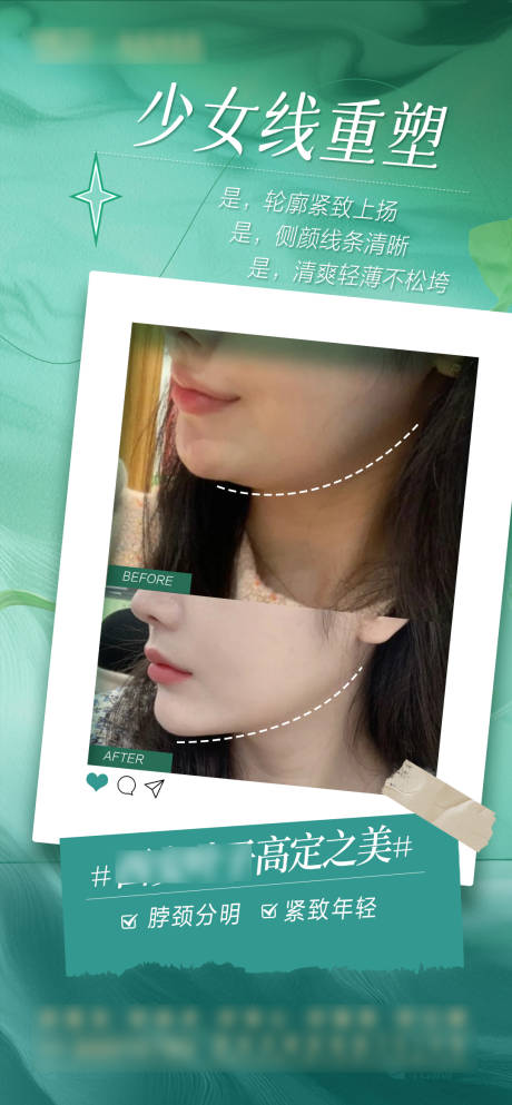 少女线下颌缘案例海报