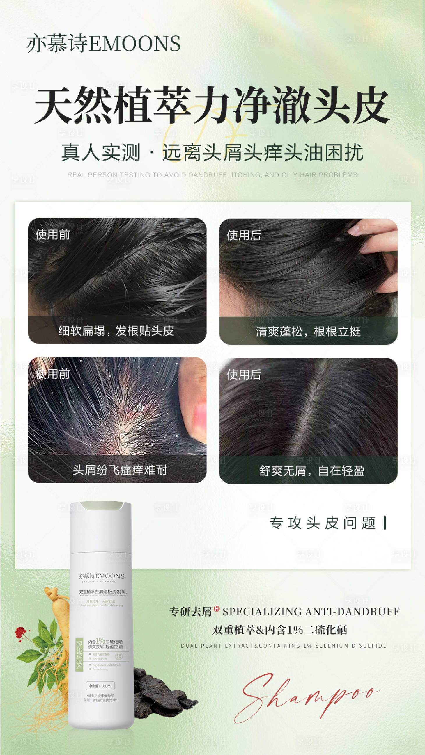 源文件下载【享设计】搜索编号：39130029563935276【洗发乳头皮去屑对比海报】