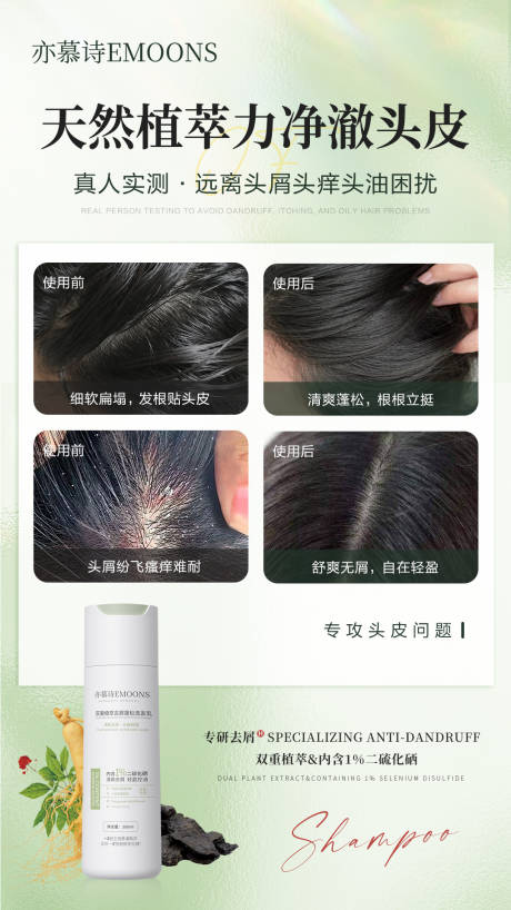洗发乳头皮去屑对比海报