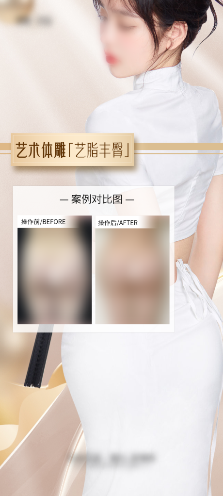 源文件下载【医美丰臀案例海报】编号：69260029491539870
