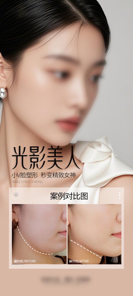 源文件下载【医美V脸案例海报】编号：95670029593744780