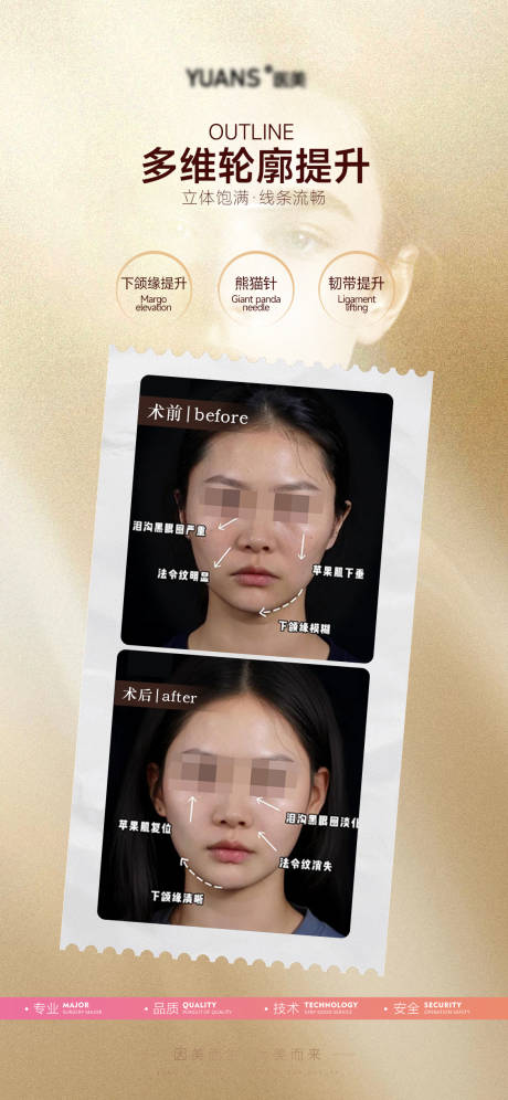 源文件下载【轮廓提升对比案例】编号：17590029863061453