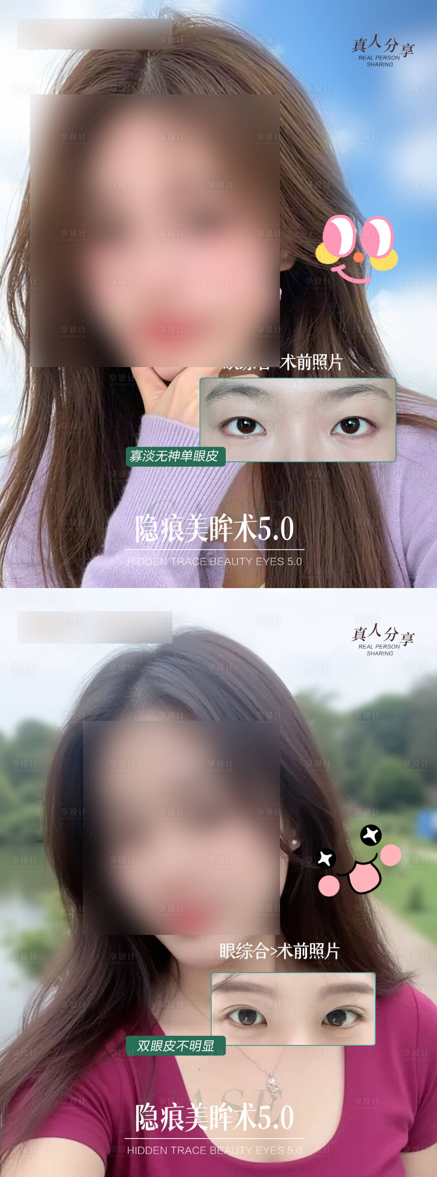 源文件下载【享设计】搜索编号：97340029187376376【双眼皮 】