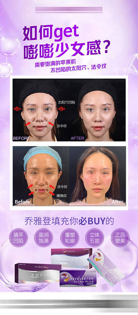 源文件下载【乔雅登面部填充案例海报】编号：24520029844379319