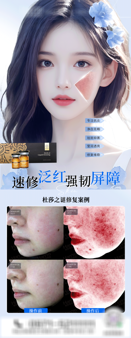 医美杜莎之谜修复敏感肌