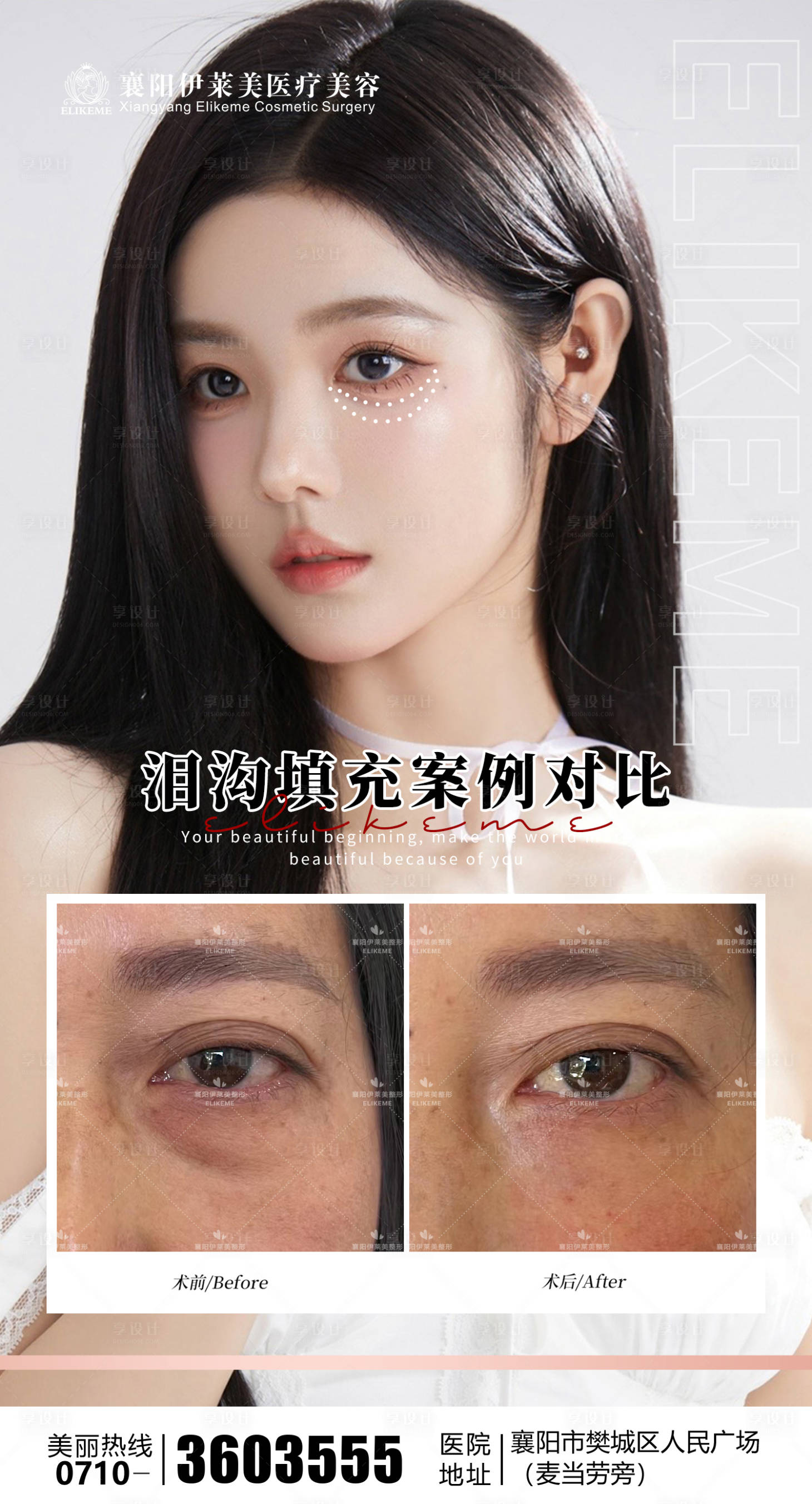 源文件下载【享设计】搜索编号：52370029586023353【医美泪沟案例海报】