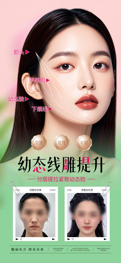 源文件下載【享設計】搜索編號：36740029789435692【醫美幼態線雕提升抗衰海報】