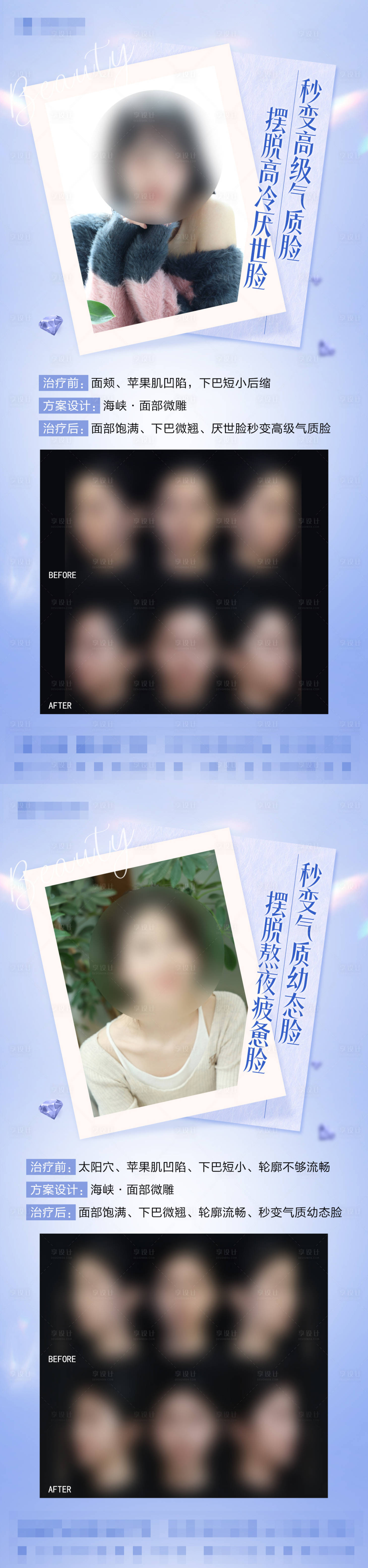 源文件下載【享設計】搜索編號：42990029387295166【潤致玻尿酸組圖】