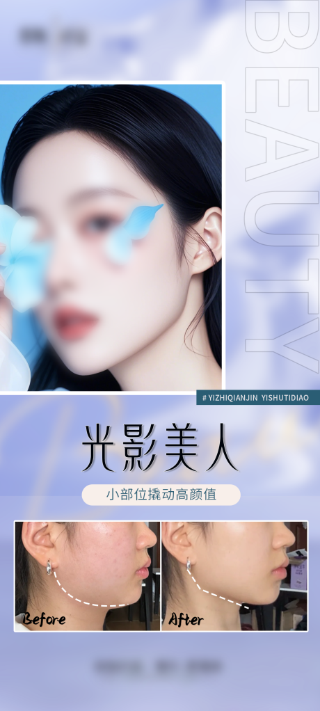 源文件下载【医美V脸案例海报】编号：60120029380802371