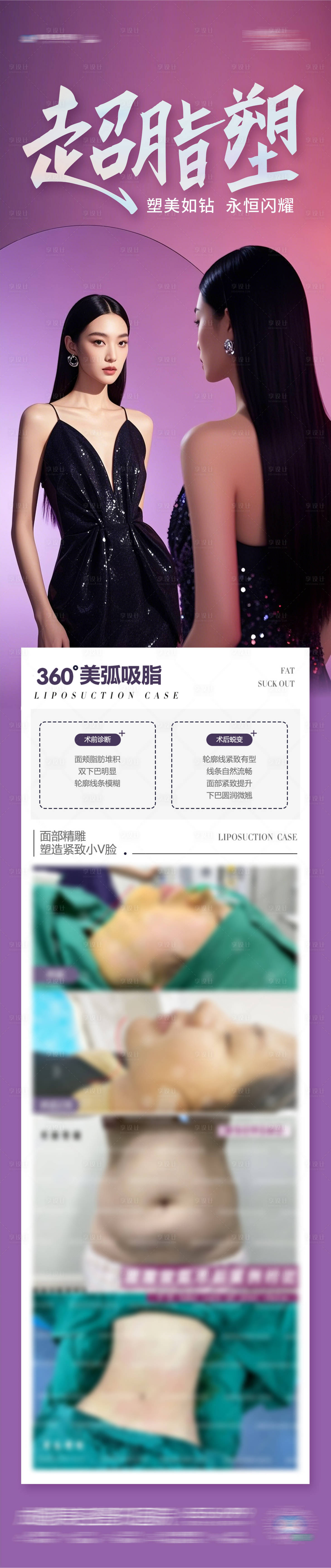 源文件下载【医美塑形案例海报】编号：75550029548788335