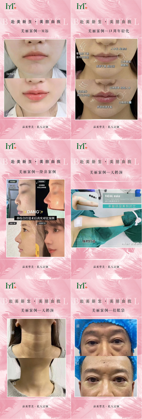 源文件下载【医美案例】编号：26170029494263975