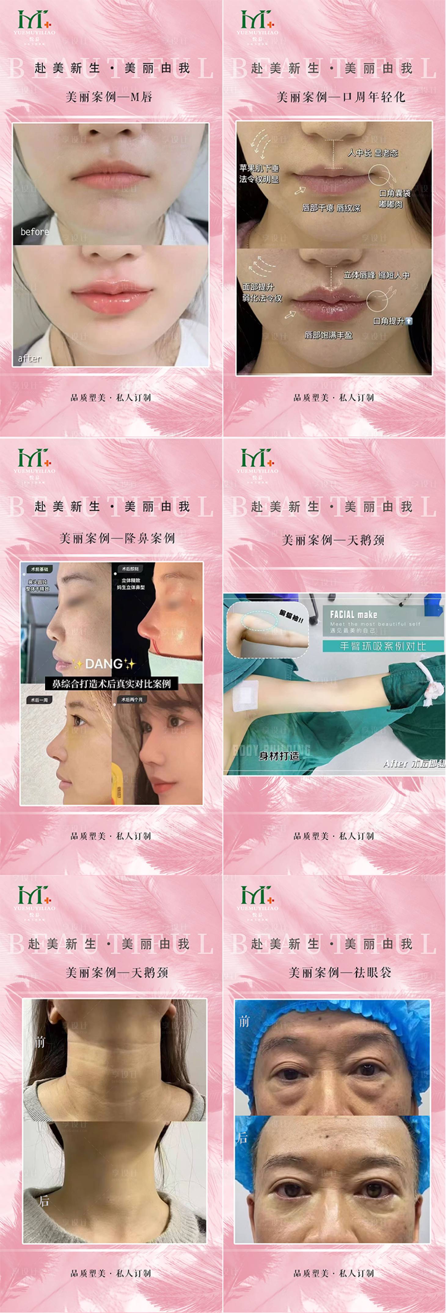 源文件下載【享設計】搜索編號：26170029494263975【醫美案例】