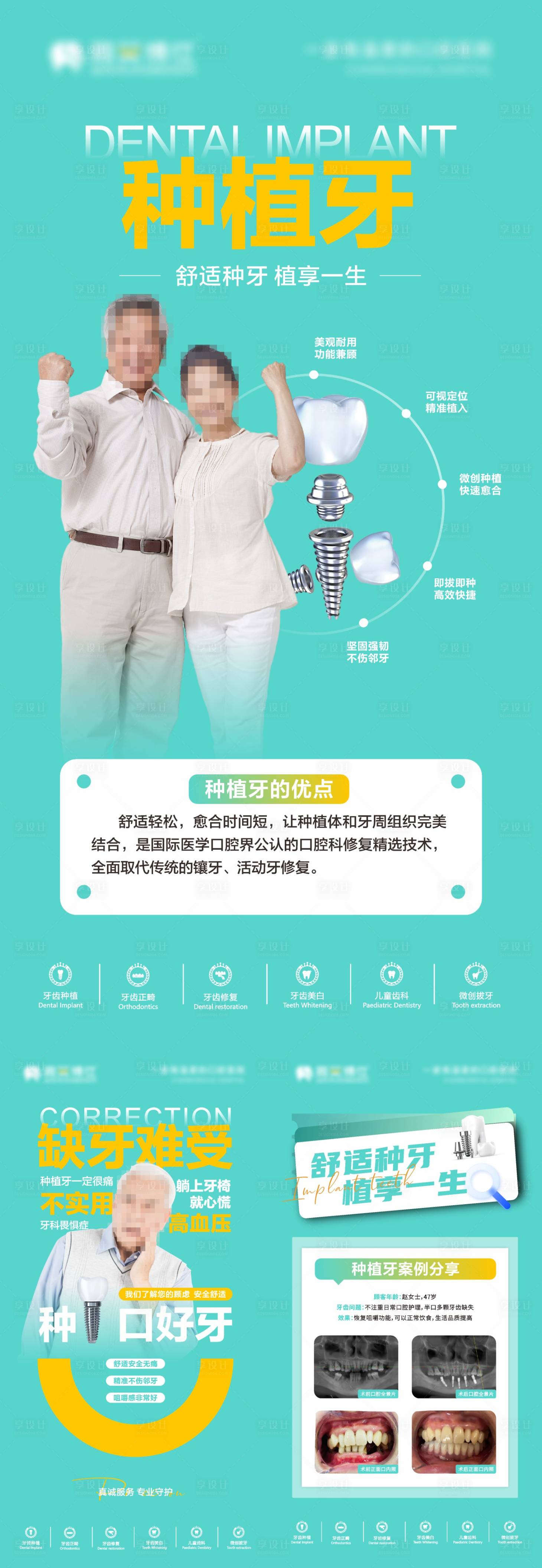 源文件下载【享设计】搜索编号：20900029860786691【种植牙口腔系列海报】