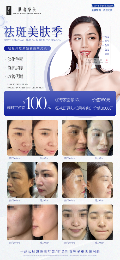 祛斑美肤季活动海报