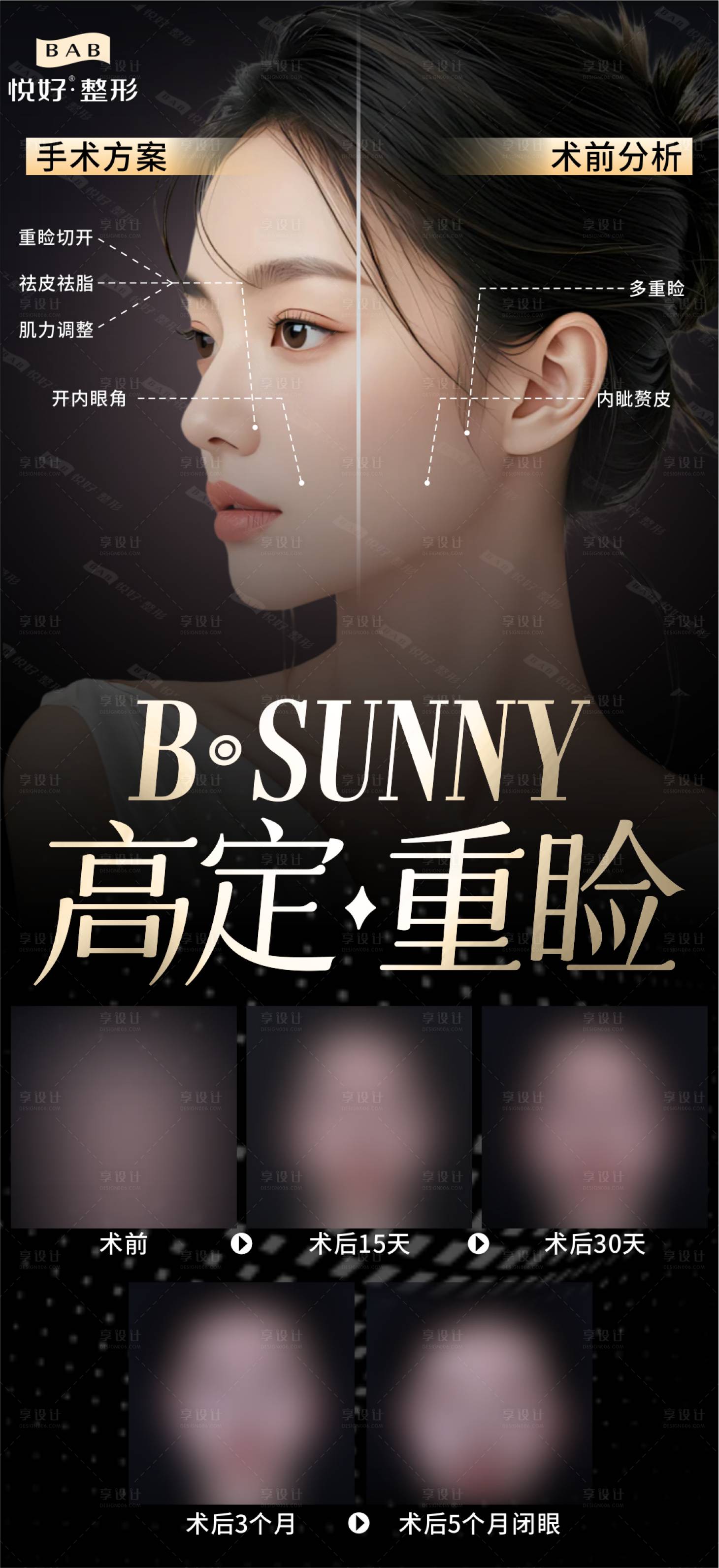 源文件下載【享設計】搜索編號：12960029235627377【雙眼皮詳解】