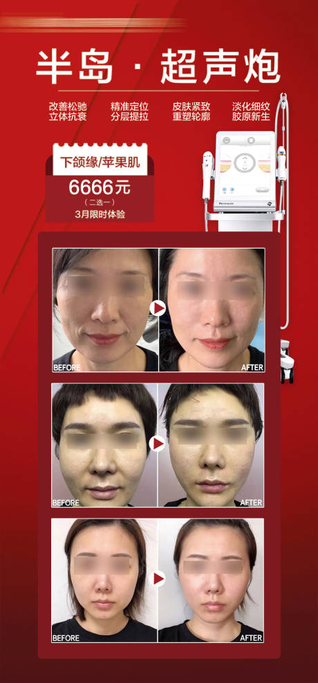 源文件下载【超声炮案例海报】编号：45040029844069313