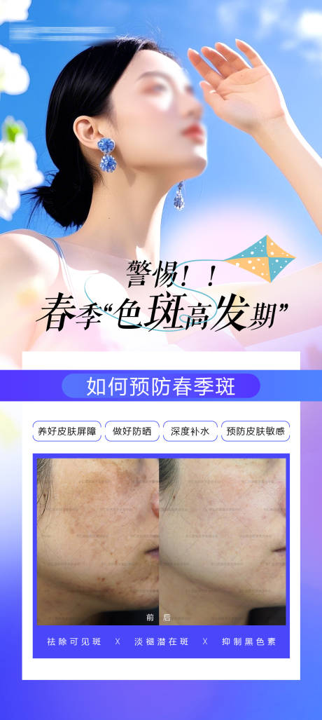 源文件下載【享設(shè)計(jì)】搜索編號(hào)：82460029616891534【醫(yī)美春天祛斑案例海報(bào)】