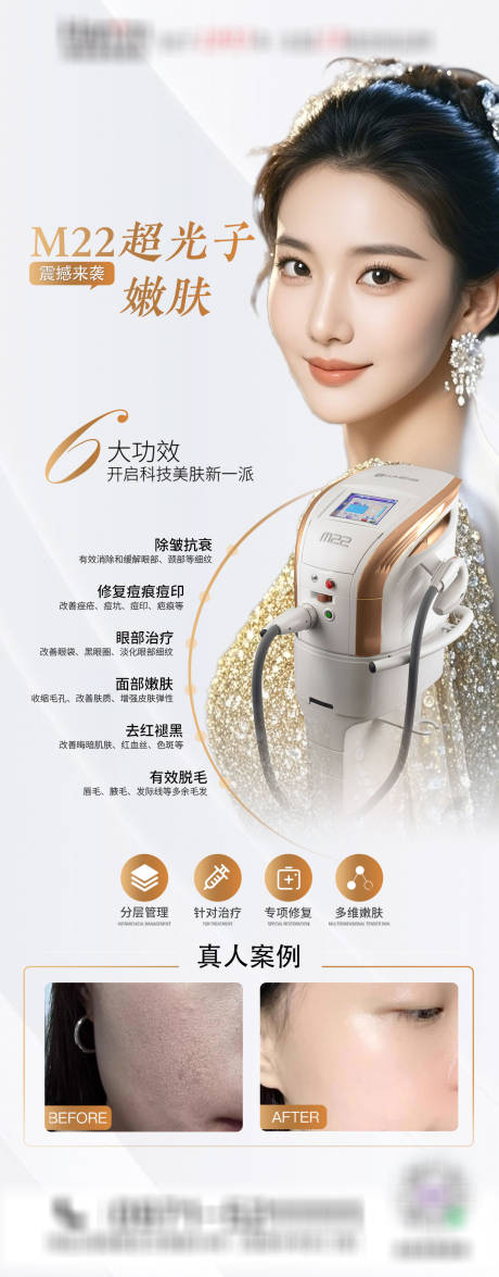 源文件下載【醫(yī)美超光子嫩膚儀器海報】編號：94930029721153683