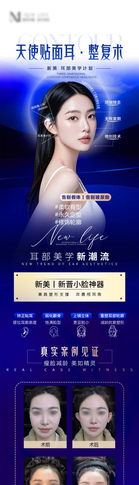 源文件下载【医美品相精灵耳宣传长图海报】编号：47210029589348659