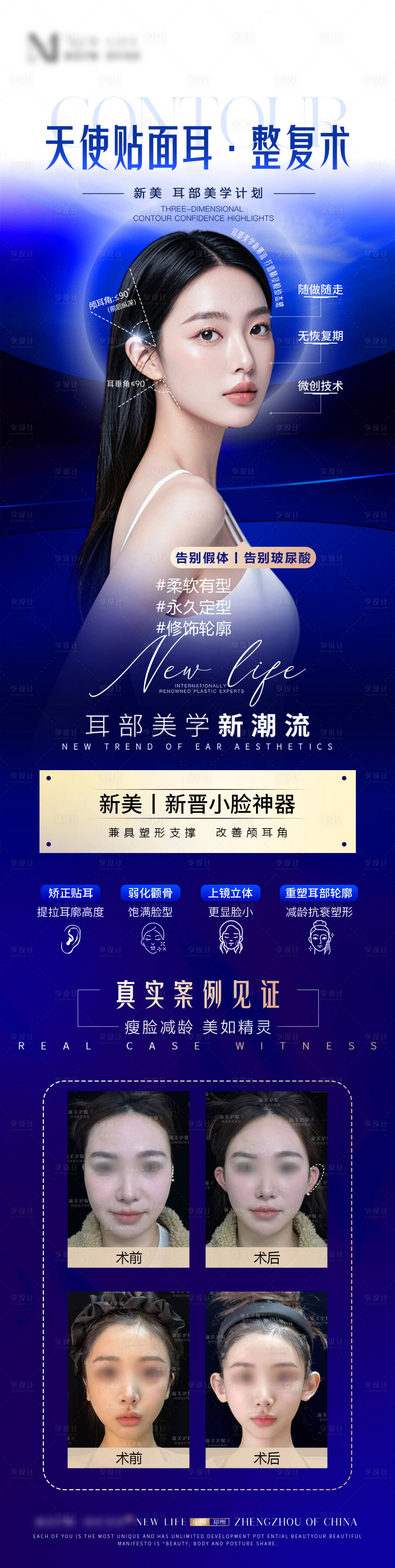 源文件下載【享設計】搜索編號：47210029589348659【醫美品相精靈耳宣傳長圖海報】