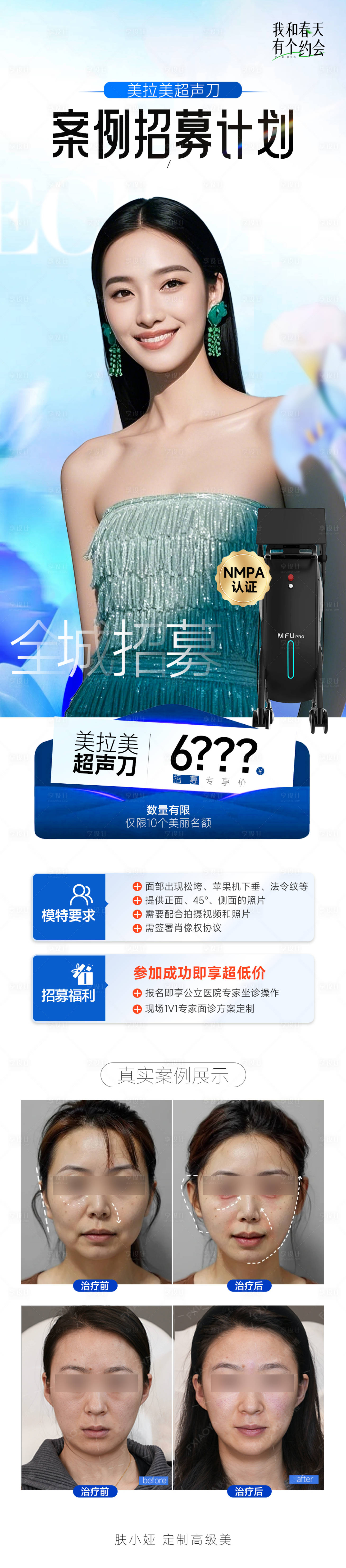 源文件下載【享設計】搜索編號：13490029759447438【美拉美超聲刀案例招募長圖】