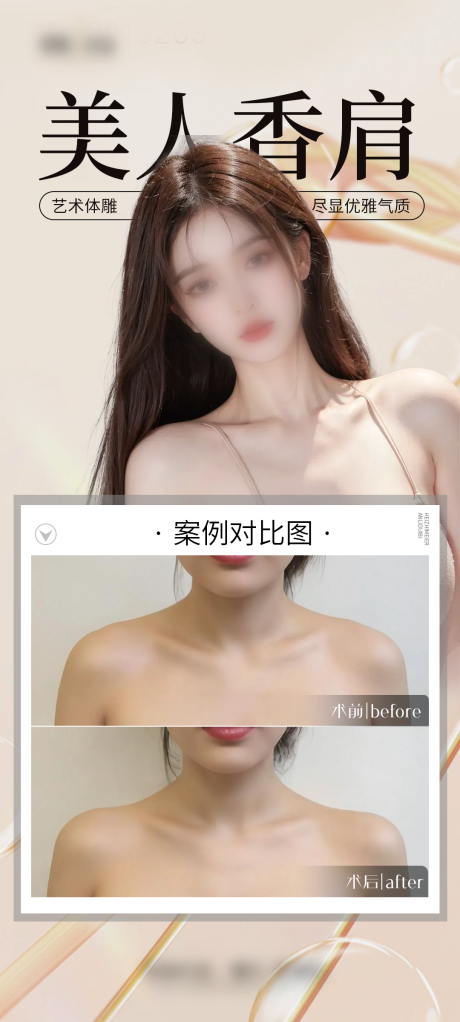 医美美人肩案例海报