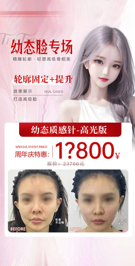 源文件下载【幼态脸注射案例海报】编号：33200029294995227