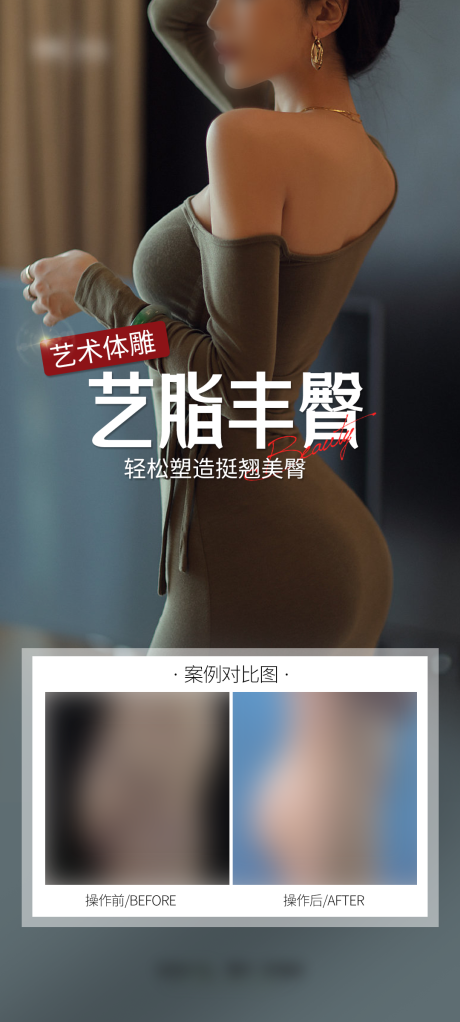 源文件下载【医美丰臀案例海报】编号：87670029442937643