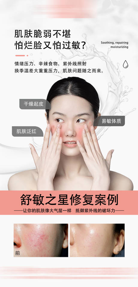舒敏之星 