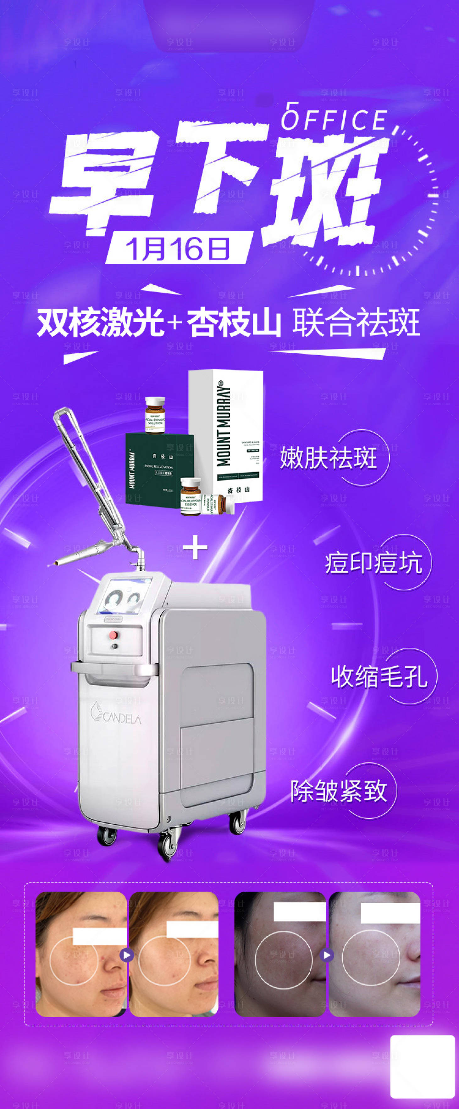 源文件下載【享設(shè)計】搜索編號：80320029406659630【超皮秒祛斑案例海報】
