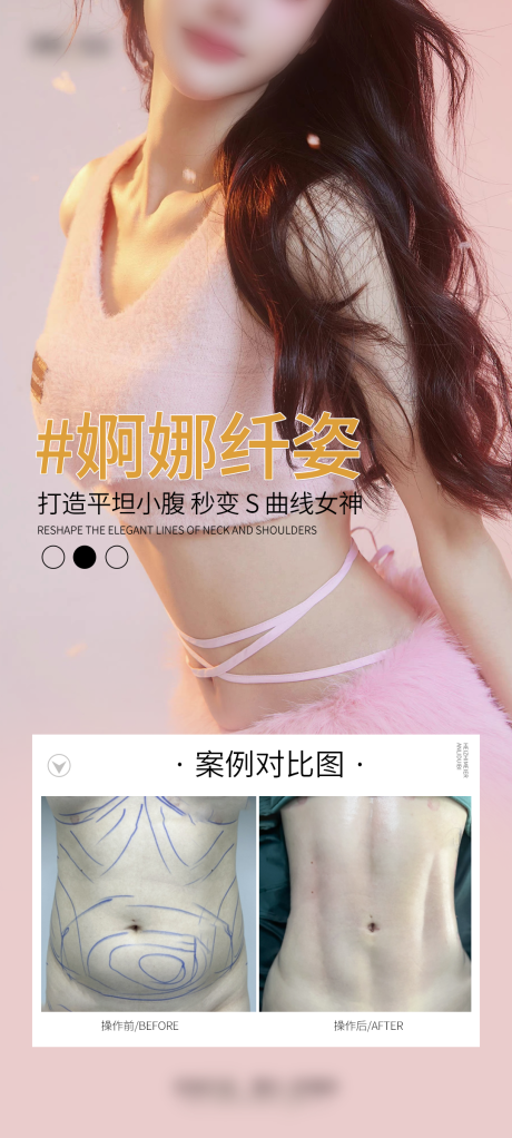 源文件下载【医美腰腹案例海报】编号：75190029381193052