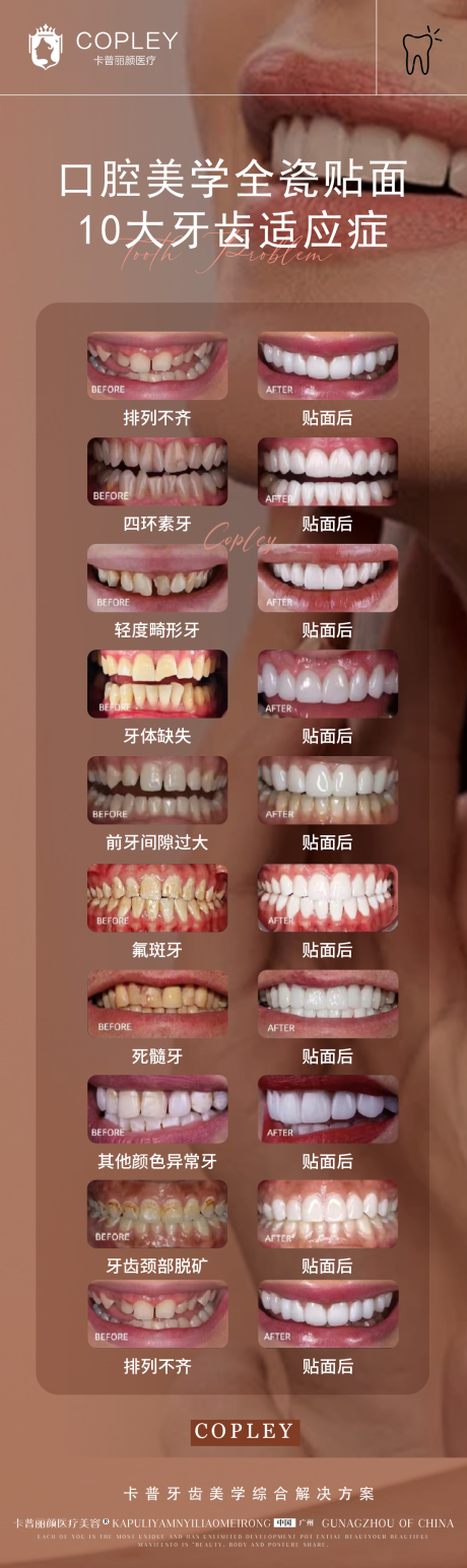 源文件下載【美學10大牙齒適應癥海報】編號：53730029302329061