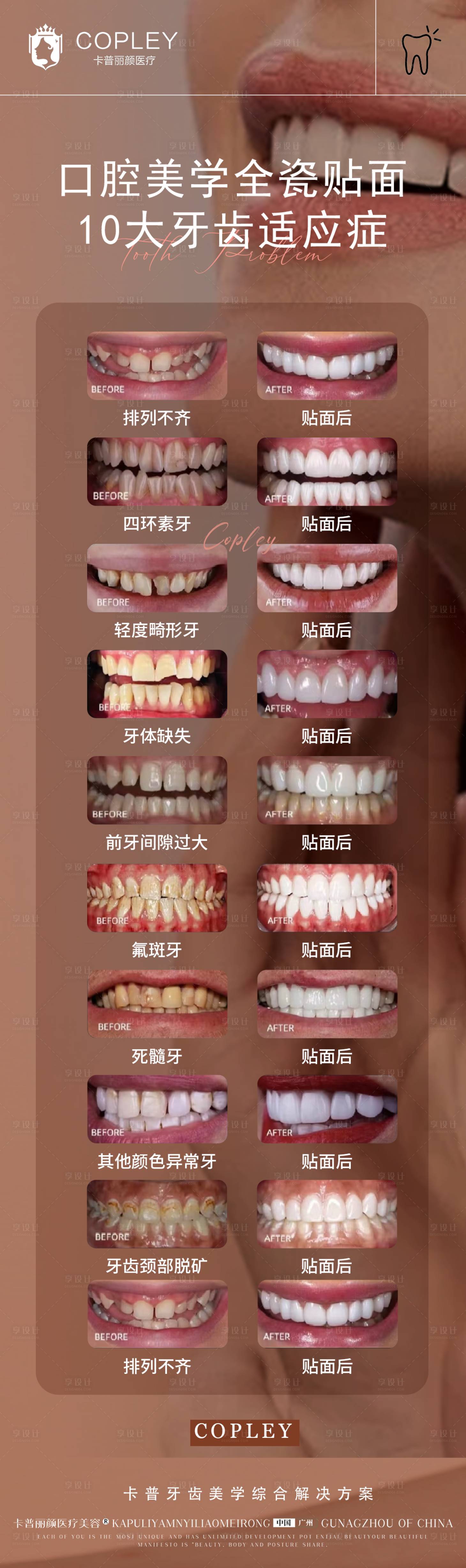 源文件下載【享設計】搜索編號：53730029302329061【美學10大牙齒適應癥海報】