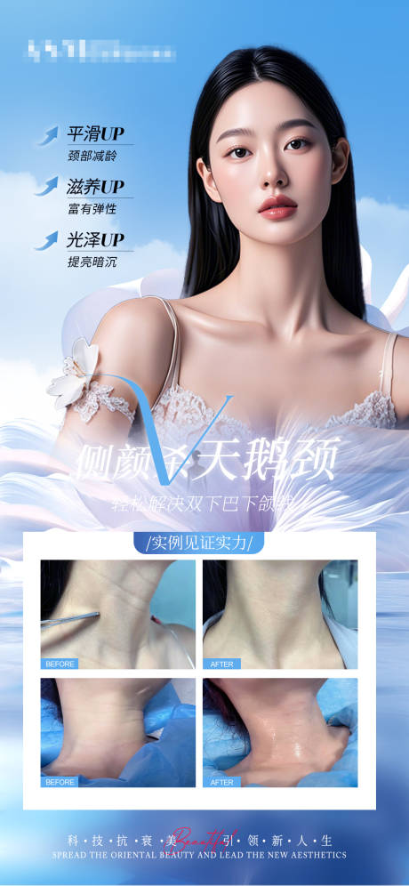 医美天鹅美颈颈部抗衰宣传对比海报