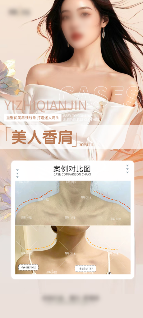 医美肩案例海报
