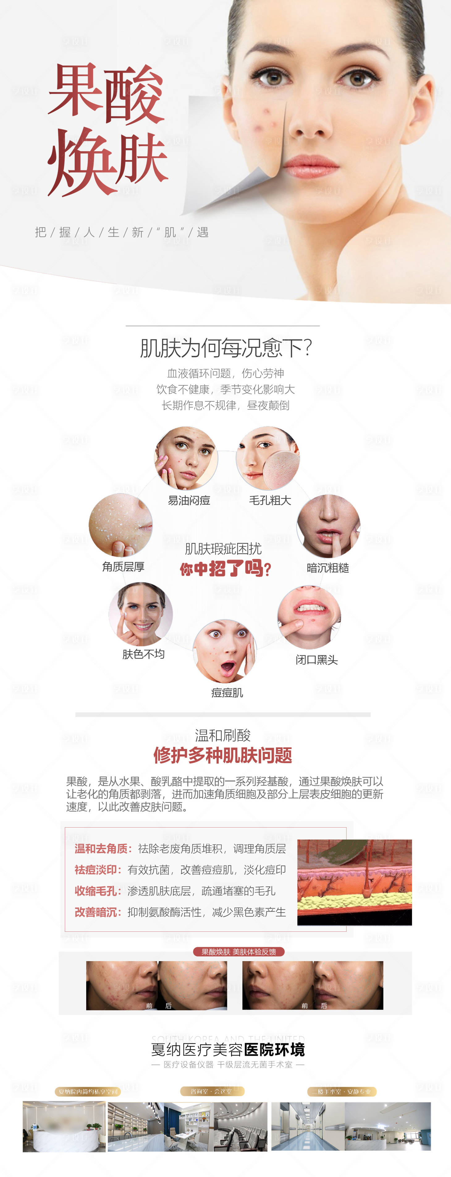 源文件下載【享設(shè)計(jì)】搜索編號(hào)：76300029228539020【醫(yī)療美容皮膚科網(wǎng)站果酸煥膚專題詳情】