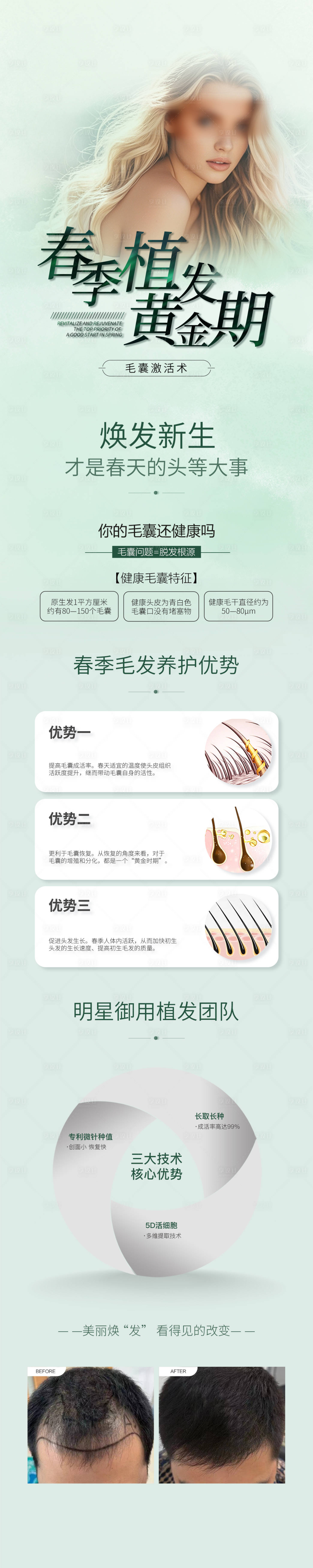 源文件下载【享设计】搜索编号：50690029784598408【春季植发黄金期长图】